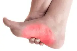 Person suffering from arch pain