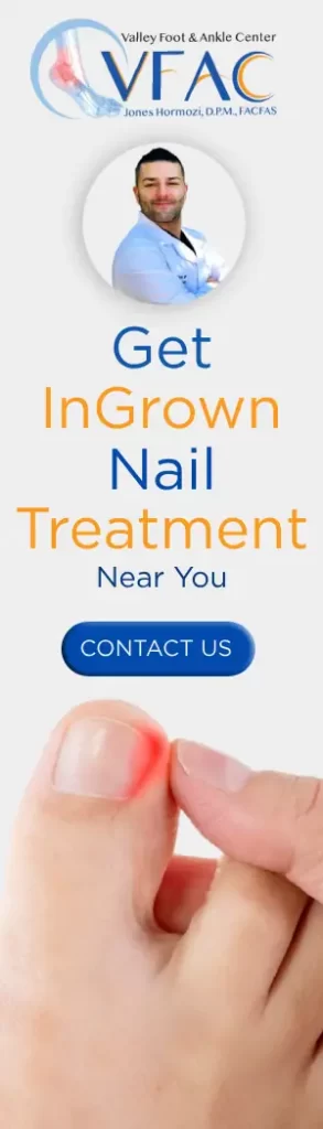 Definitive Guide to Ingrown Toenail Treatment and Expenses