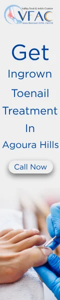 Ingrown Toenail:Prevention,Expert Care &Treatment in Agoura Hills