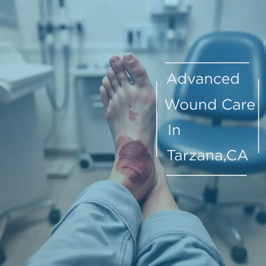 Advanced Wound Care in Tarzana