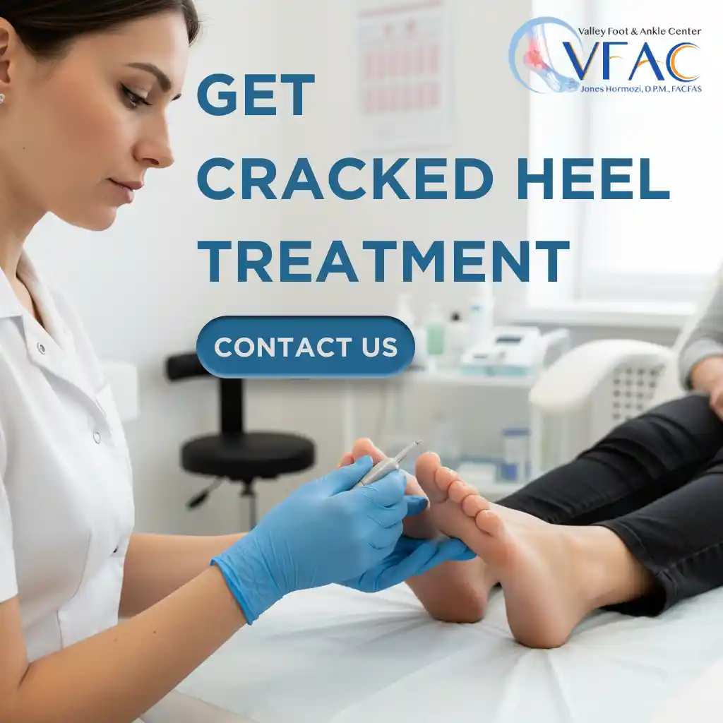 Cracked Heel Treatment : Valley Foot & Ankle Center